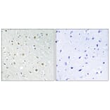 Immunohistochemistry - Anti-SSBP2 Antibody (C10803) - Antibodies.com