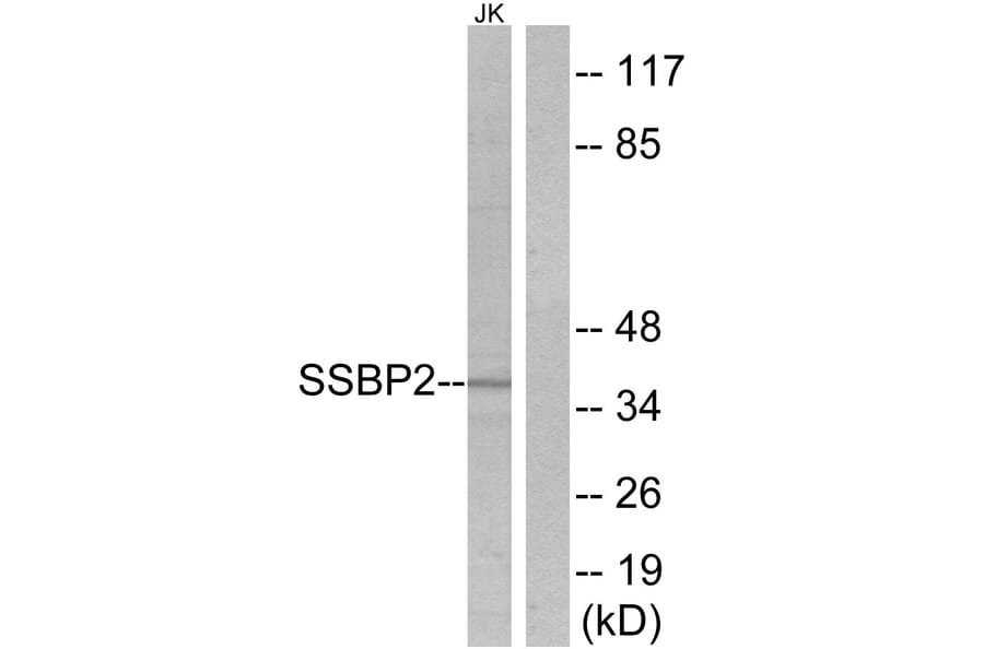 Western Blot - Anti-SSBP2 Antibody (C10803) - Antibodies.com
