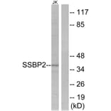 Western Blot - Anti-SSBP2 Antibody (C10803) - Antibodies.com