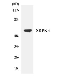 Western Blot - Anti-SRPK3 Antibody (R12-3561) - Antibodies.com