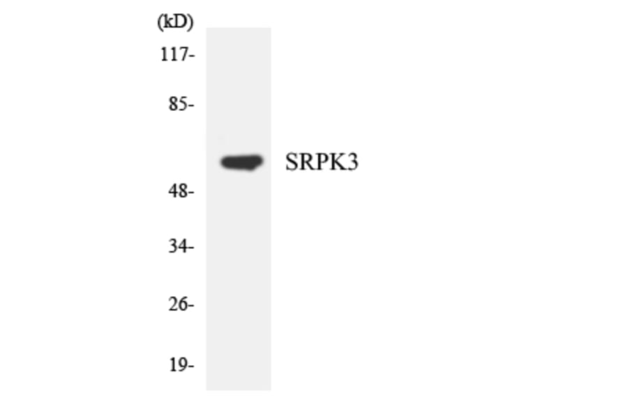 Western Blot - Anti-SRPK3 Antibody (R12-3561) - Antibodies.com