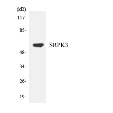 Western Blot - Anti-SRPK3 Antibody (R12-3561) - Antibodies.com