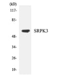 Western Blot - Anti-SRPK3 Antibody (R12-3561) - Antibodies.com