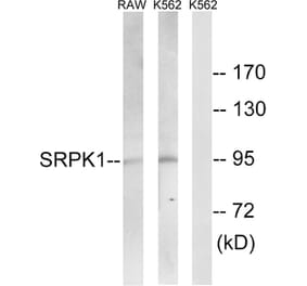 Western Blot - Anti-SRPK1 Antibody (C18616) - Antibodies.com
