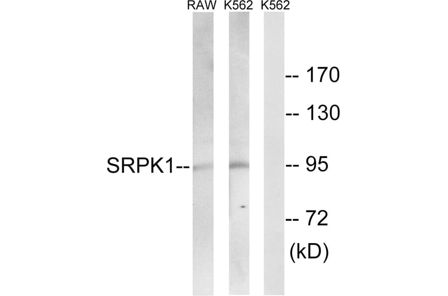 Western Blot - Anti-SRPK1 Antibody (C18616) - Antibodies.com