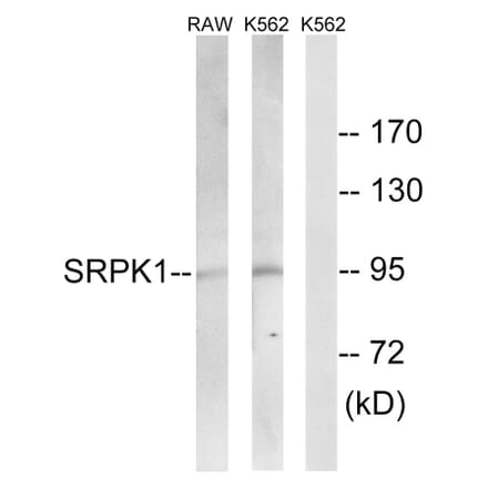 Western Blot - Anti-SRPK1 Antibody (C18616) - Antibodies.com
