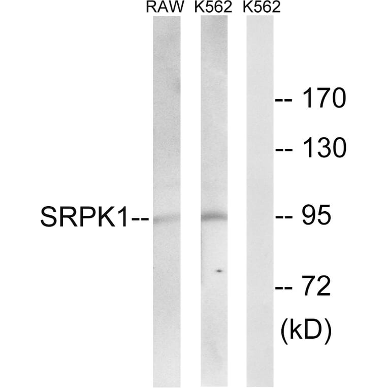 Western Blot - Anti-SRPK1 Antibody (C18616) - Antibodies.com