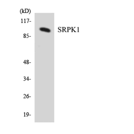 Western Blot - Anti-SRPK1 Antibody (R12-3560) - Antibodies.com