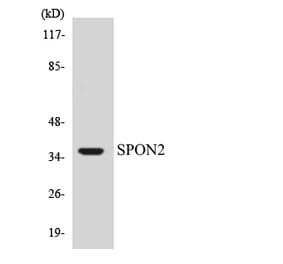 Western Blot - Anti-SPON2 Antibody (R12-3557) - Antibodies.com