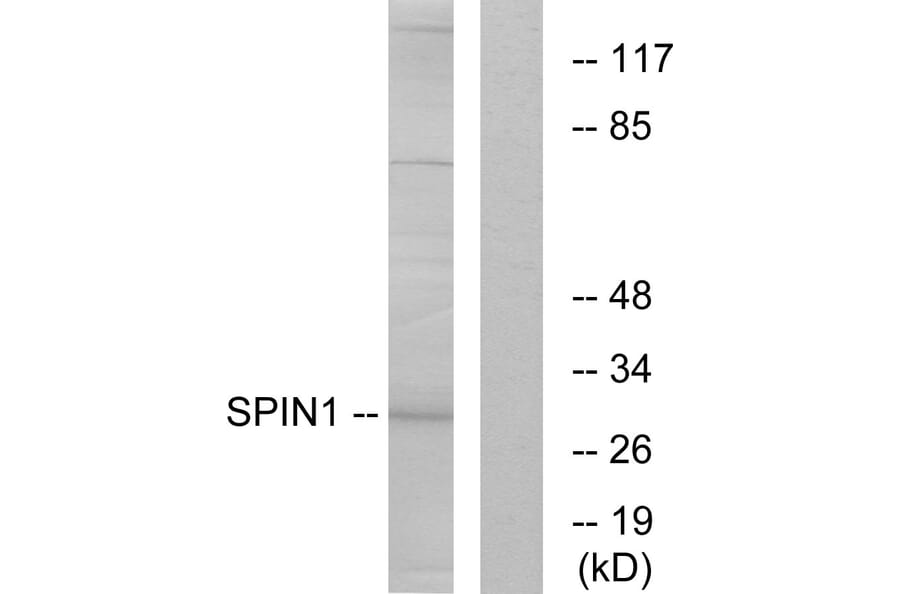Western Blot - Anti-SPIN1 Antibody (C11983) - Antibodies.com