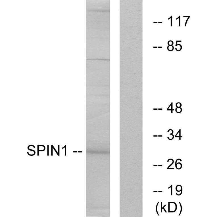 Western Blot - Anti-SPIN1 Antibody (C11983) - Antibodies.com