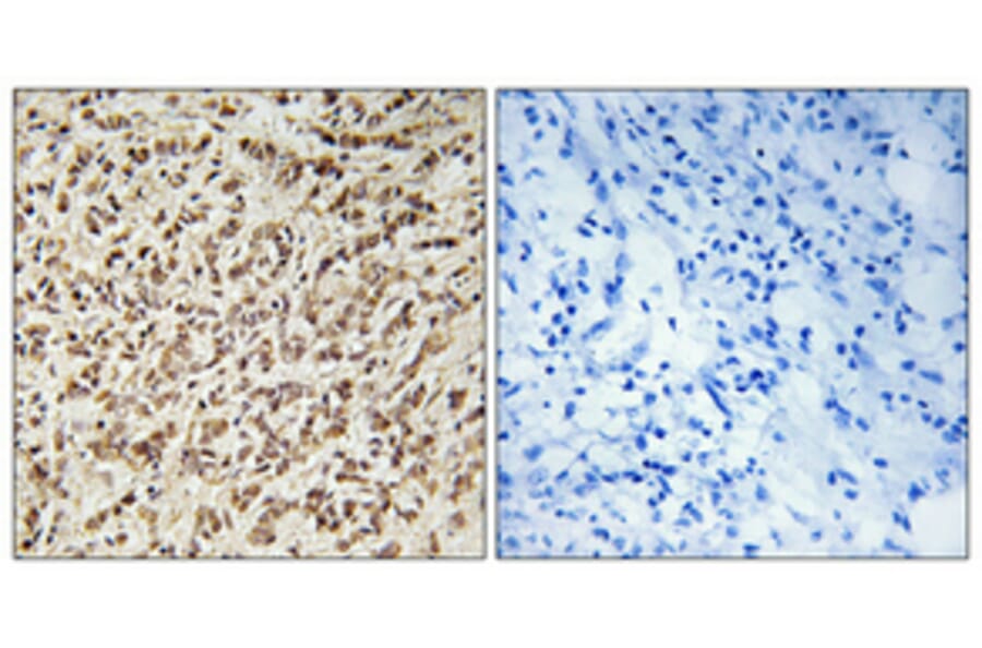 Immunohistochemistry - Anti-SPIN1 Antibody (C11983) - Antibodies.com
