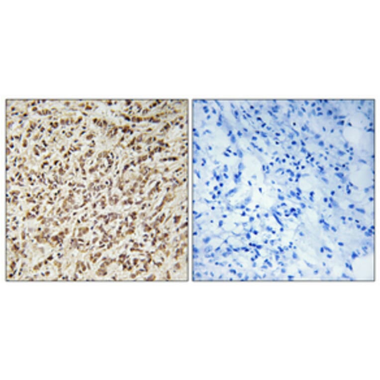 Immunohistochemistry - Anti-SPIN1 Antibody (C11983) - Antibodies.com