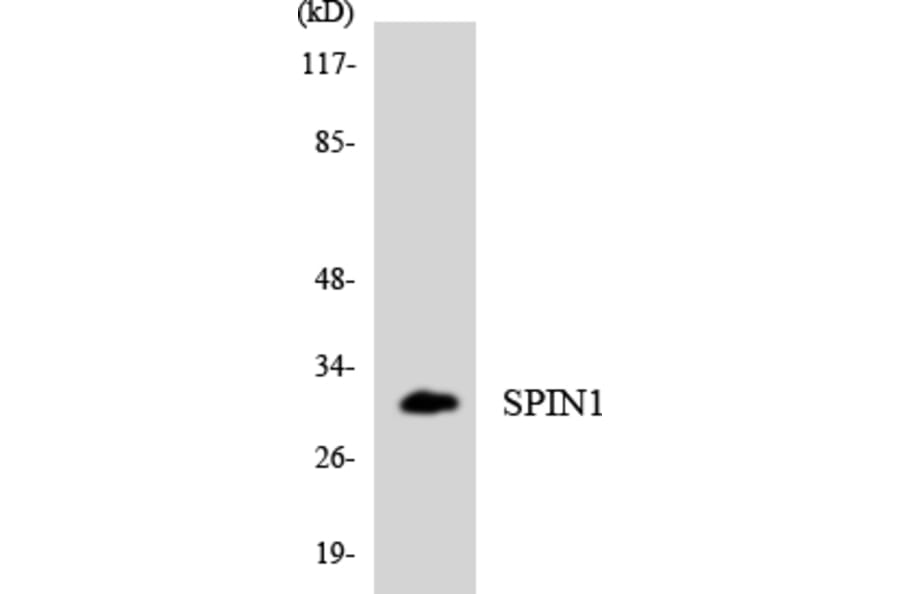 Western Blot - Anti-SPIN1 Antibody (R12-3555) - Antibodies.com
