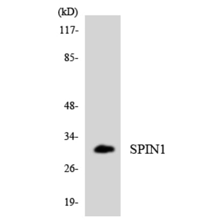 Western Blot - Anti-SPIN1 Antibody (R12-3555) - Antibodies.com