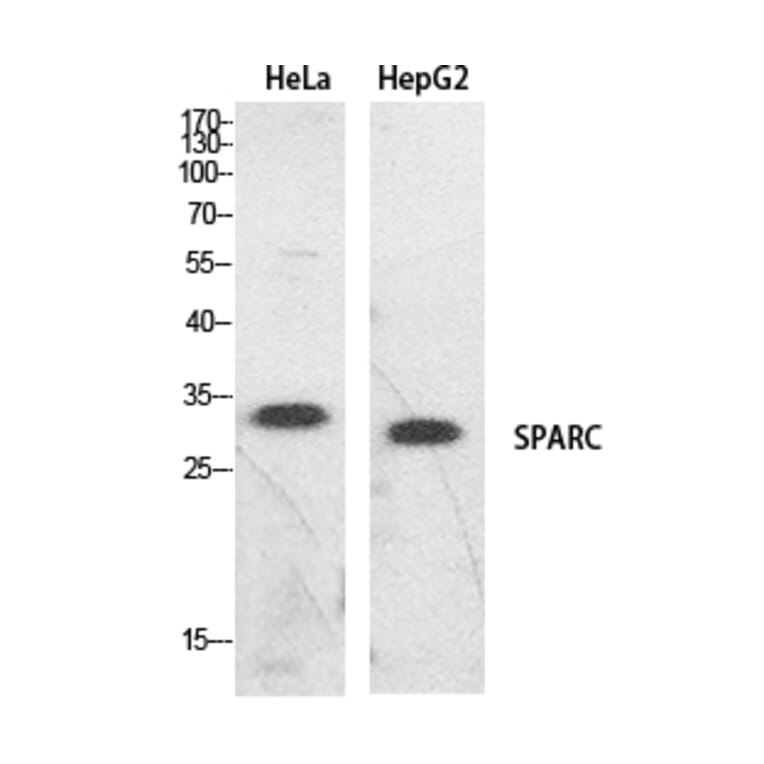 Western Blot - Anti-SPARC Antibody (C30227) - Antibodies.com