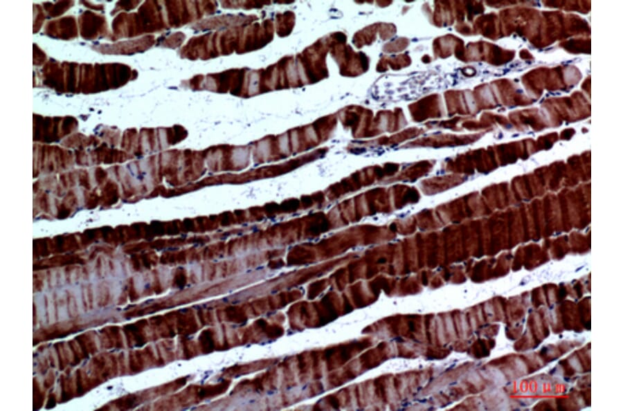 Immunohistochemistry - Anti-SPARC Antibody (C30227) - Antibodies.com