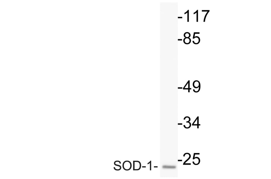 Western Blot - Anti-SOD-1 Antibody (R12-2363) - Antibodies.com