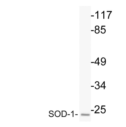 Western Blot - Anti-SOD-1 Antibody (R12-2363) - Antibodies.com