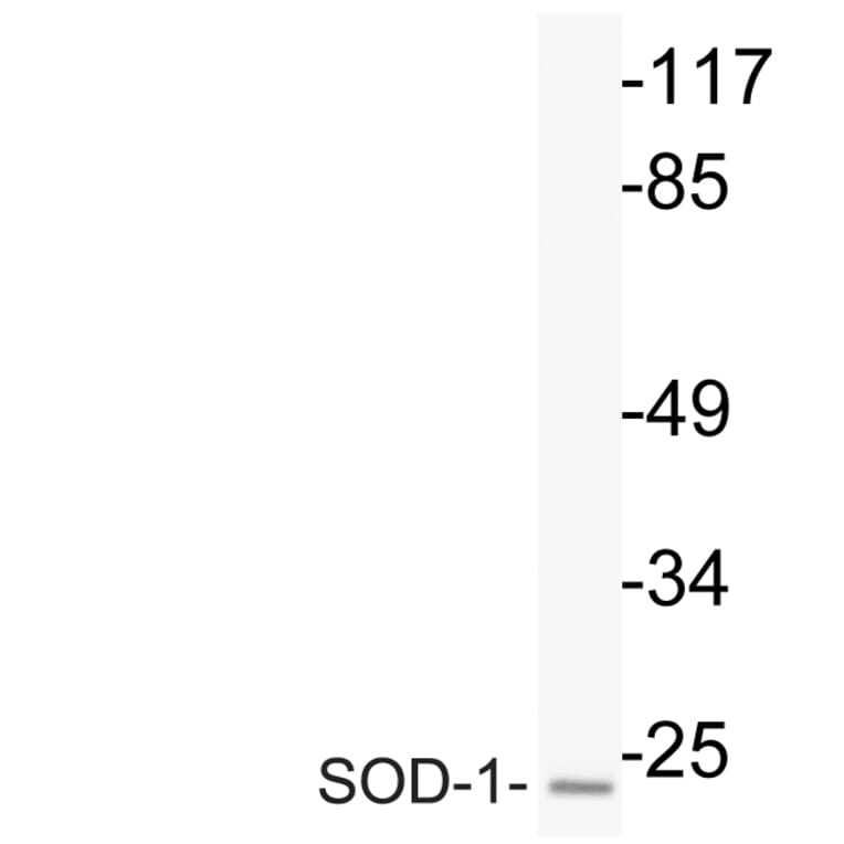 Western Blot - Anti-SOD-1 Antibody (R12-2363) - Antibodies.com