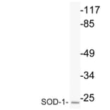 Western Blot - Anti-SOD-1 Antibody (R12-2363) - Antibodies.com