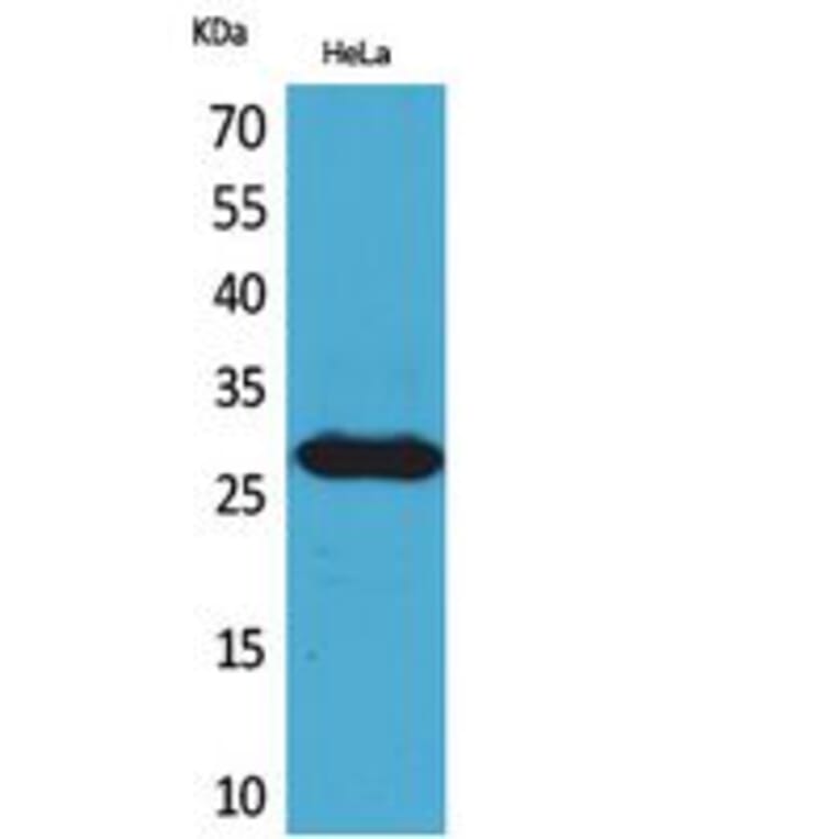 Western Blot - Anti-SNRPN Antibody (C30295) - Antibodies.com