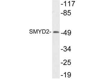 Western Blot - Anti-SMYD2 Antibody (R12-2359) - Antibodies.com