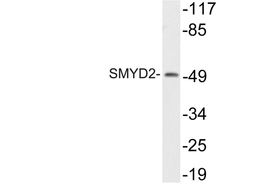 Western Blot - Anti-SMYD2 Antibody (R12-2359) - Antibodies.com