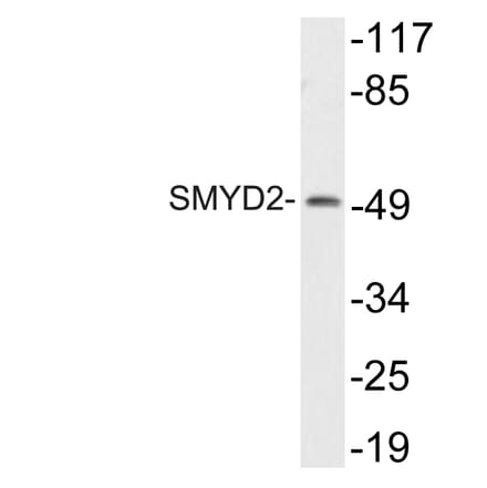 Western Blot - Anti-SMYD2 Antibody (R12-2359) - Antibodies.com