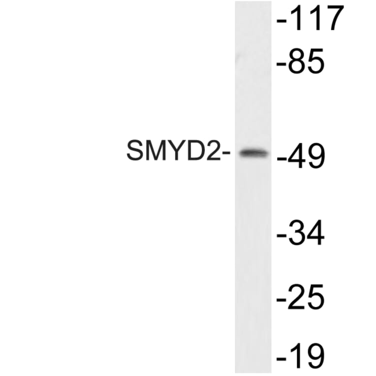 Western Blot - Anti-SMYD2 Antibody (R12-2359) - Antibodies.com