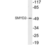 Western Blot - Anti-SMYD2 Antibody (R12-2359) - Antibodies.com