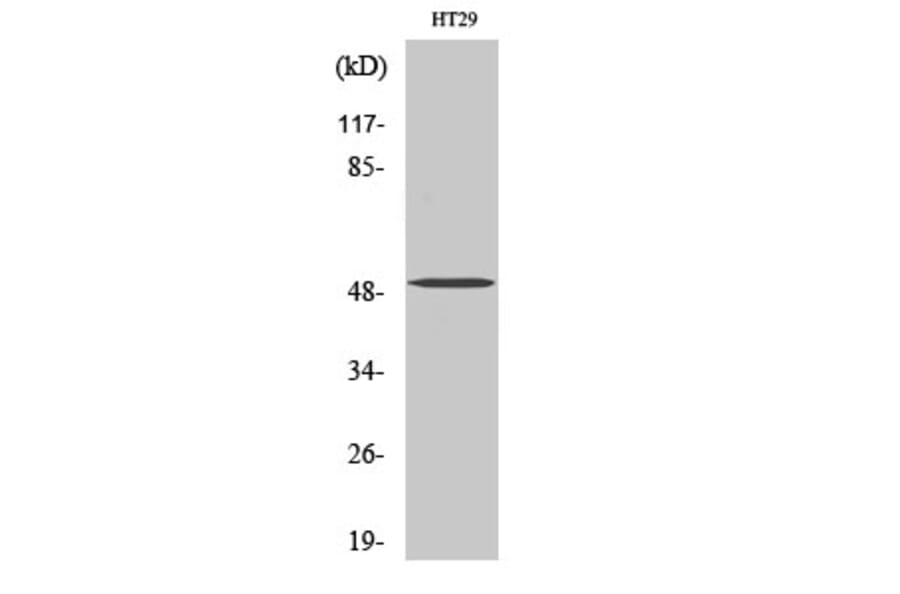Western Blot - Anti-SMYD2 Antibody (R12-2359) - Antibodies.com