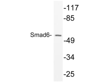 Western Blot - Anti-Smad6 Antibody (R12-2358) - Antibodies.com