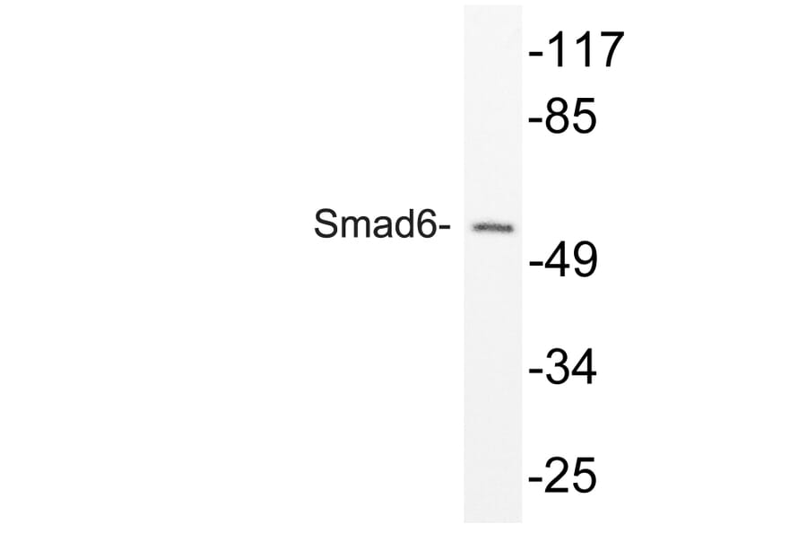 Western Blot - Anti-Smad6 Antibody (R12-2358) - Antibodies.com