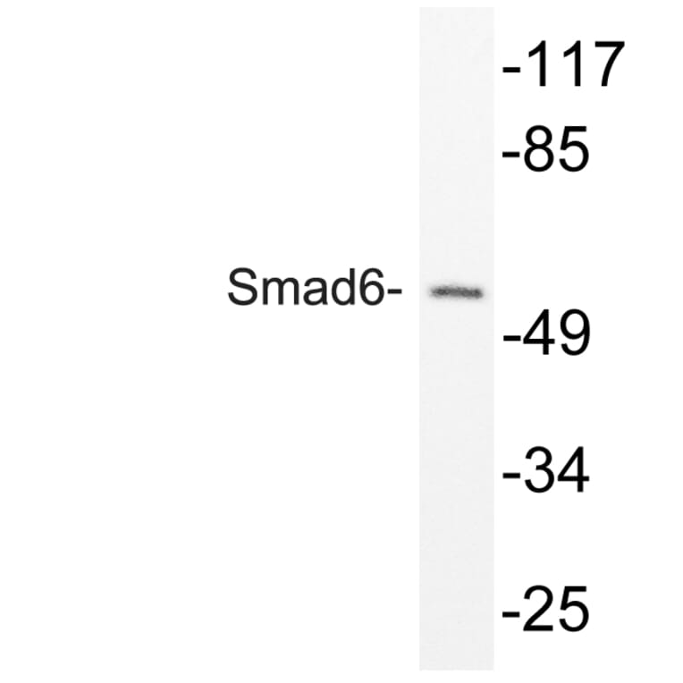 Western Blot - Anti-Smad6 Antibody (R12-2358) - Antibodies.com