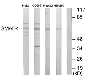 Western Blot - Anti-Smad4 Antibody (C10983) - Antibodies.com