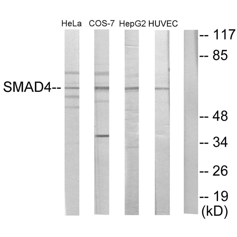 Western Blot - Anti-Smad4 Antibody (C10983) - Antibodies.com