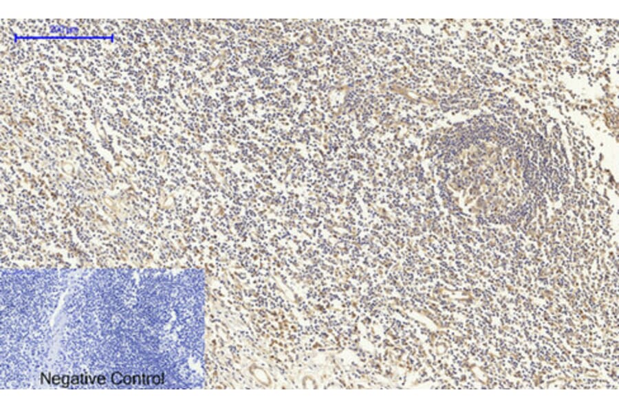 Immunohistochemistry - Anti-Smad4 Antibody (C10983) - Antibodies.com