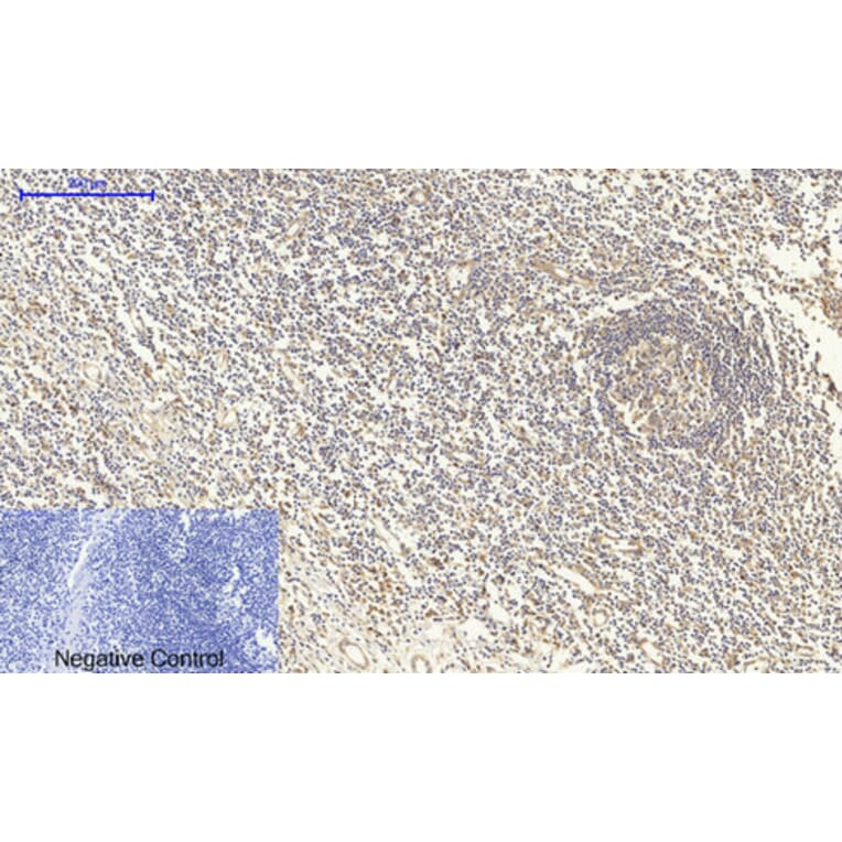 Immunohistochemistry - Anti-Smad4 Antibody (C10983) - Antibodies.com