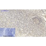 Immunohistochemistry - Anti-Smad4 Antibody (C10983) - Antibodies.com