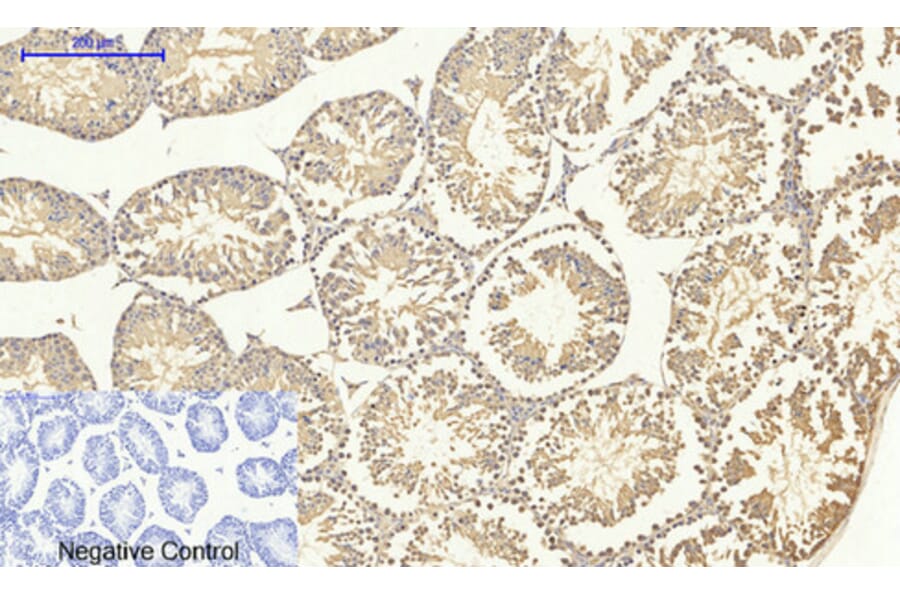 Immunohistochemistry - Anti-Smad4 Antibody (C10983) - Antibodies.com