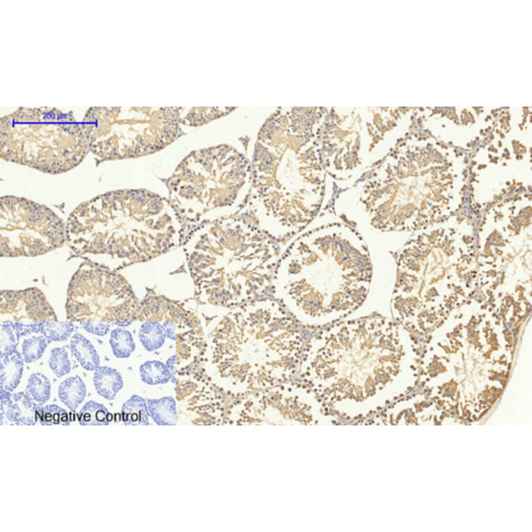 Immunohistochemistry - Anti-Smad4 Antibody (C10983) - Antibodies.com