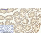 Immunohistochemistry - Anti-Smad4 Antibody (C10983) - Antibodies.com