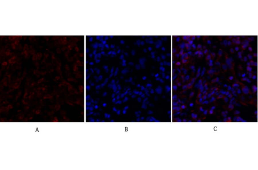 Immunofluorescence - Anti-Smad4 Antibody (C10983) - Antibodies.com