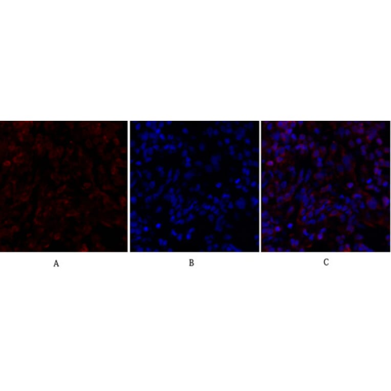 Immunofluorescence - Anti-Smad4 Antibody (C10983) - Antibodies.com