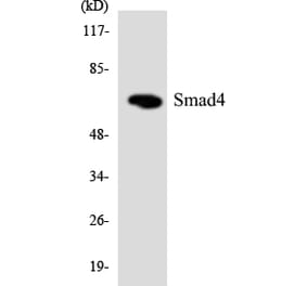 Western Blot - Anti-Smad4 Antibody (R12-3546) - Antibodies.com