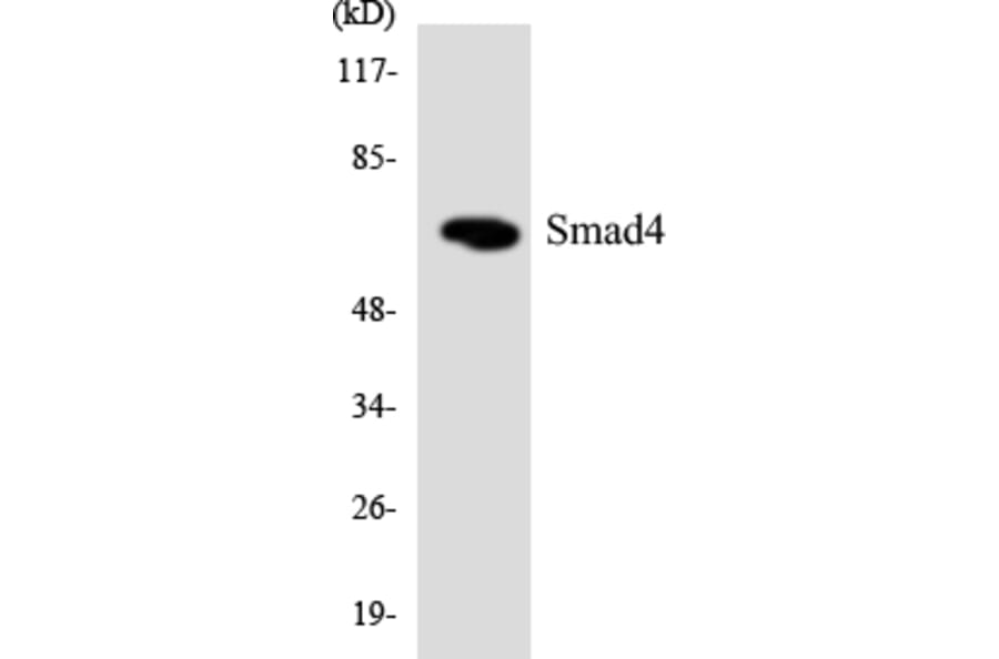 Western Blot - Anti-Smad4 Antibody (R12-3546) - Antibodies.com