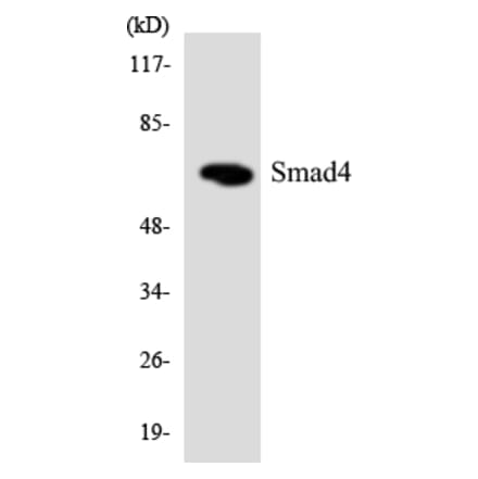 Western Blot - Anti-Smad4 Antibody (R12-3546) - Antibodies.com
