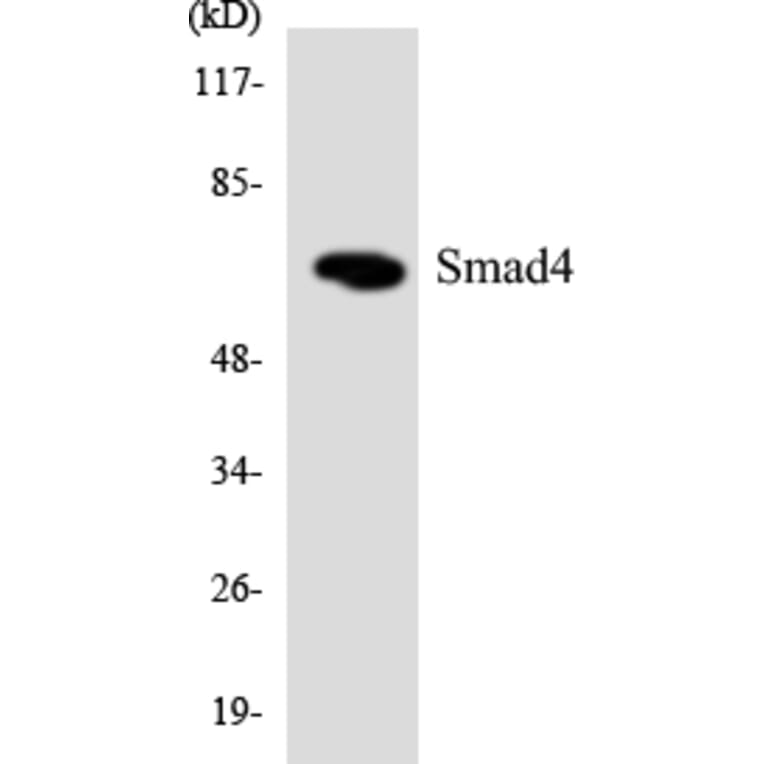 Western Blot - Anti-Smad4 Antibody (R12-3546) - Antibodies.com