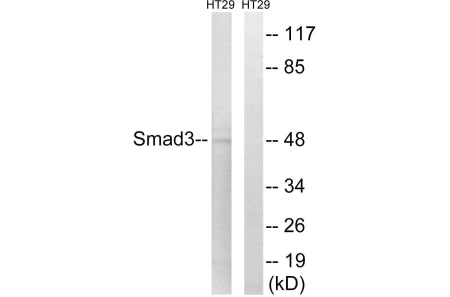 Western Blot - Anti-Smad3 Antibody (B1003) - Antibodies.com
